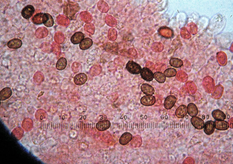 4 - Agaricus bisporus, spore x 1000.jpg