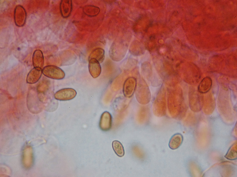 9 - Pholiotina aporus spore x 1000 in rosso congo.jpg