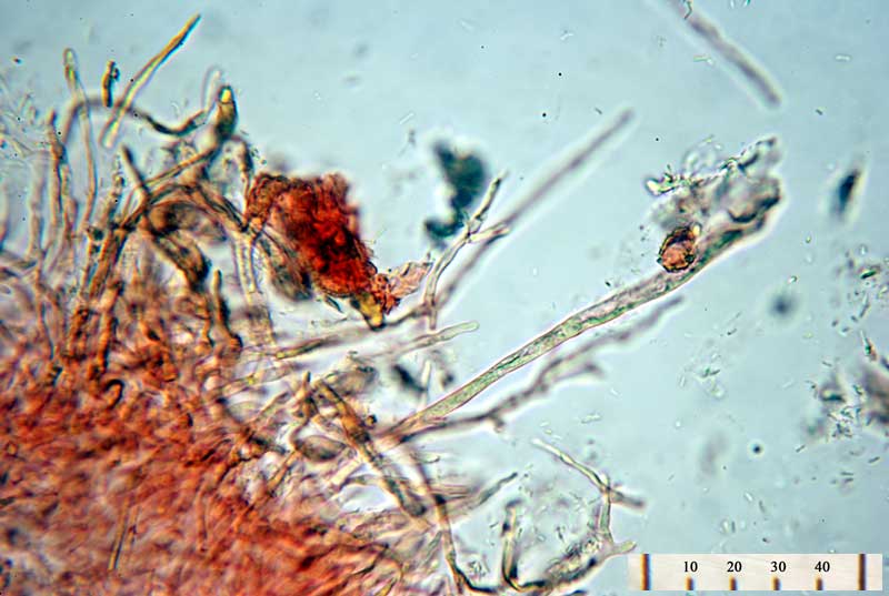 R. globispora - dermatocistidi