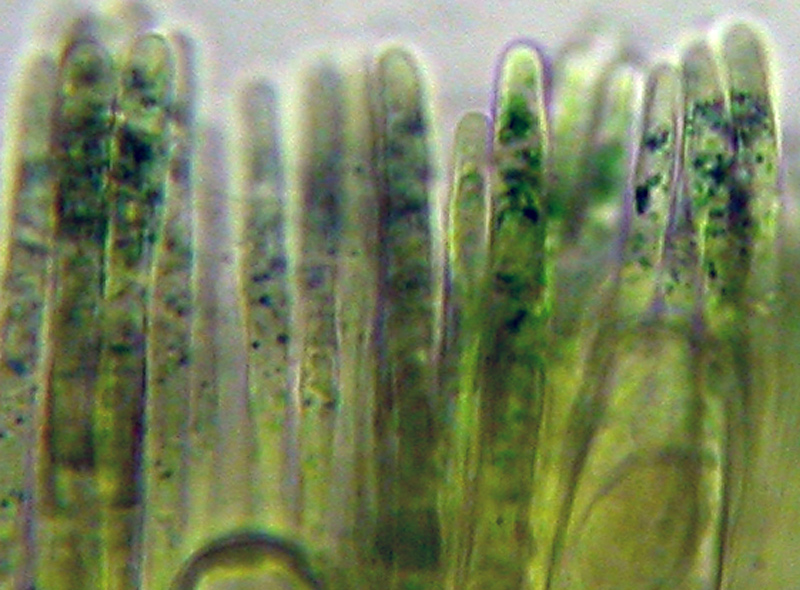 Sarcoscypha coccinea - parafisi in Melzer's.jpg