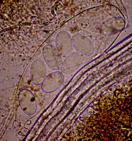 Ascobolus immersus Pers (57)Asco e spore x400.jpg