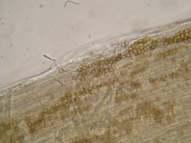 004-DSCN3651 caulocistidi nella parte bassa del gambo.jpg