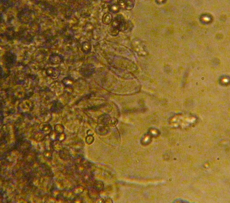 Micro Leucoagaricus bresadolae 1231 - Copia.JPG