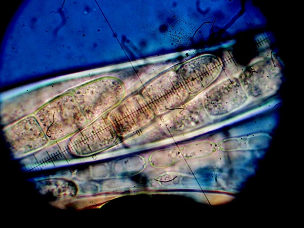 Sporormiella cylindrospora S.I. Ahmed & Cain, (5).jpg