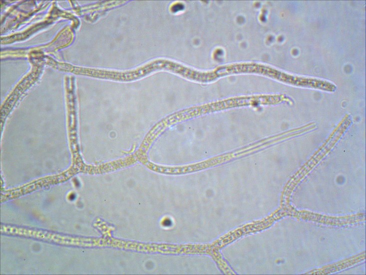 Dacrymyces stillatus ife 1000 (3) (Copia).jpg