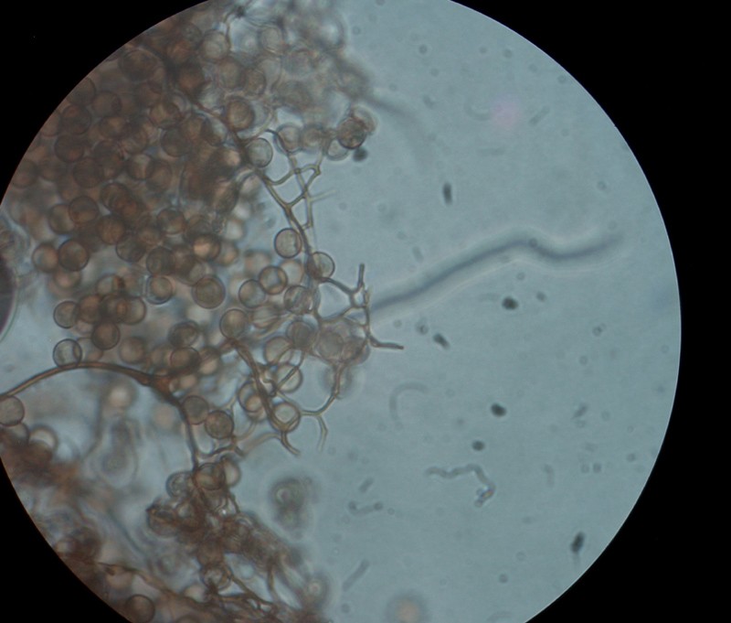 Stemonitis splendens, spore e capillizio x 400.jpg
