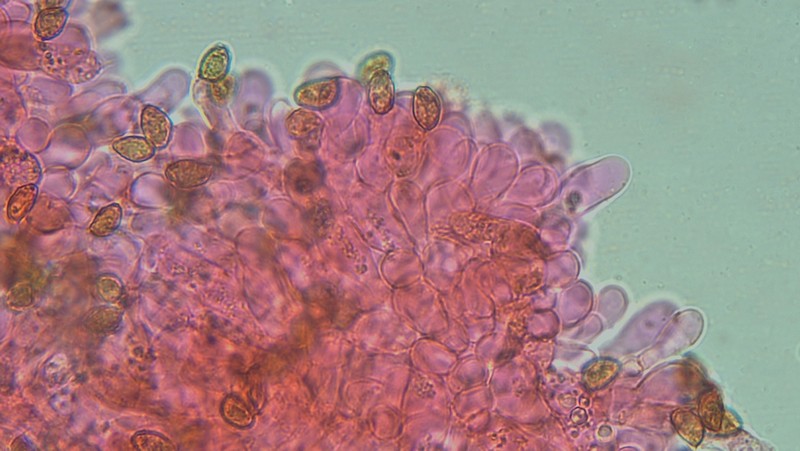 Cellule sterili 600 i 7.jpg