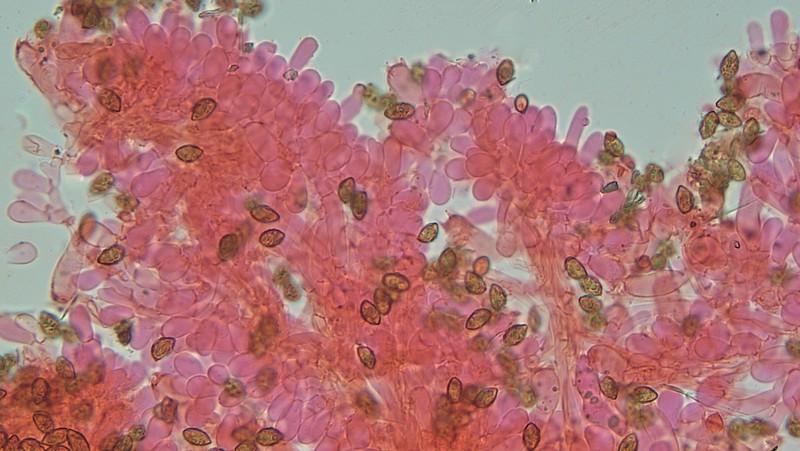 Cellule sterili 400 i 7.jpg
