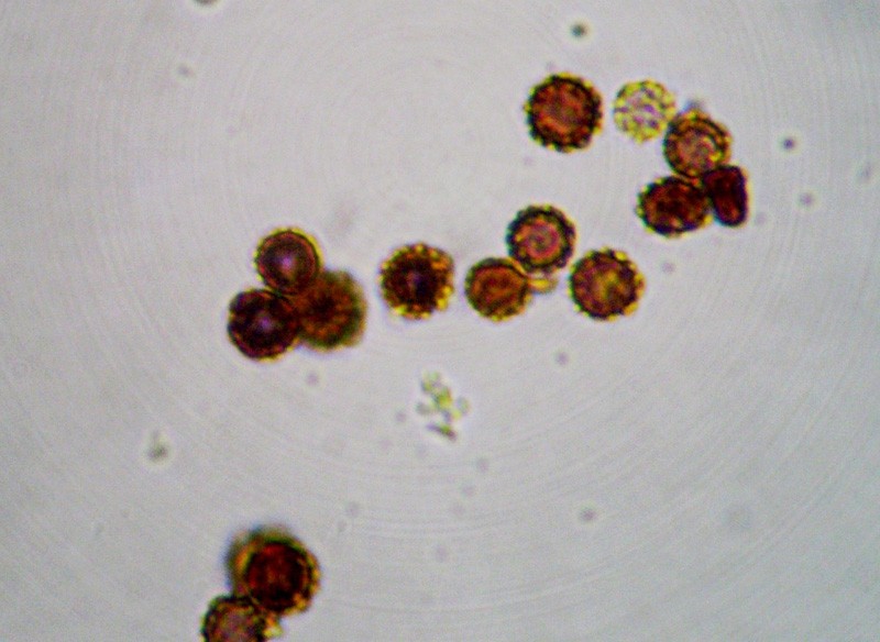 9 - Geastrum melanocephalum. spore x 1000 4.jpg